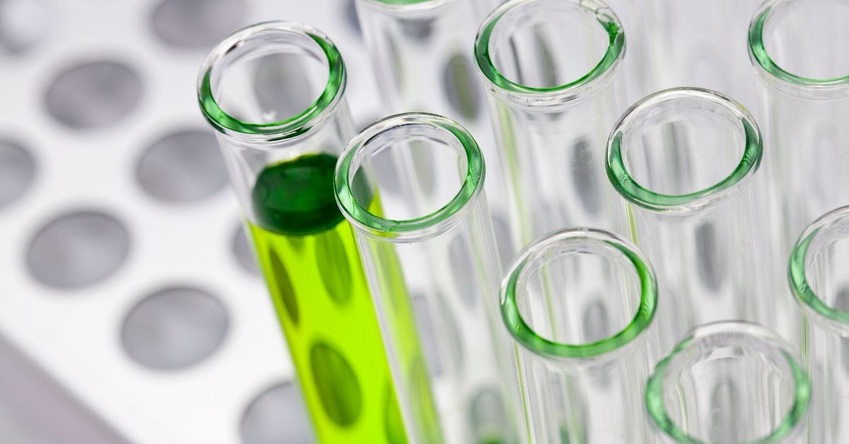 photo of a rack of test tubes with one tube filled with green liquid